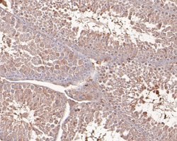 NSUN4 Monoclonal Antibody (4G4), Invitrogen 100 &mu;L; Unconjugated:Antibodies,