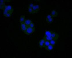 Invitrogen AGTR1 Monoclonal Antibody (11B3) 100 &mu;L; Unconjugated:Antibodies,