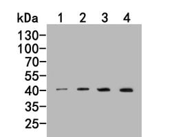 Invitrogen AGTR1 Monoclonal Antibody (11B3) 100 &mu;L; Unconjugated:Antibodies,