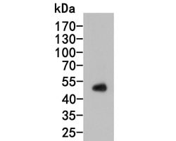 Invitrogen Thymidine Phosphorylase Monoclonal Antibody (A1A8) 100 &mu;L;