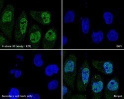 Invitrogen H3K27ac Monoclonal Antibody (A6D7) 100 &mu;L; Unconjugated:Antibodies,