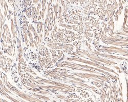 Invitrogen CLIC2 Monoclonal Antibody (A5G9) 100 &mu;L; Unconjugated:Antibodies,