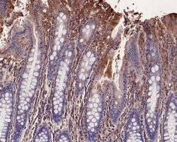 Invitrogen LRP6 Monoclonal Antibody (A5E7) 100 &mu;L; Unconjugated:Antibodies,