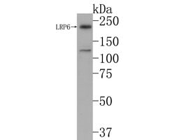 Invitrogen LRP6 Monoclonal Antibody (A5E7) 100 &mu;L; Unconjugated:Antibodies,