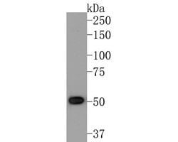 Invitrogen ACVR2B Monoclonal Antibody (A5H6) 100 &mu;L; Unconjugated:Antibodies,