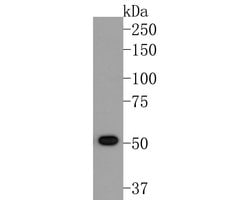 Invitrogen ACVR2B Monoclonal Antibody (A5H7) 100 &mu;L | Buy Online | Invitrogen&trade; | Fisher Scientific