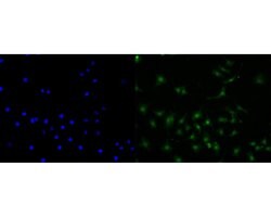 Invitrogen CENPB Monoclonal Antibody (A5F6) 100 &mu;L | Buy Online | Invitrogen&trade; | Fisher Scientific