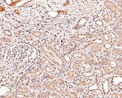 Invitrogen CENPB Monoclonal Antibody (A5F6) 100 &mu;L | Buy Online | Invitrogen&trade; | Fisher Scientific