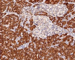 Invitrogen S6 Monoclonal Antibody (A6B8) 100 &mu;L; Unconjugated:Antibodies,