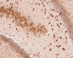 Invitrogen S6 Monoclonal Antibody (A6B8) 100 &mu;L; Unconjugated:Antibodies,