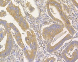 Invitrogen FAM62B Monoclonal Antibody (C4-D0) 100 &mu;L; Unconjugated:Antibodies,