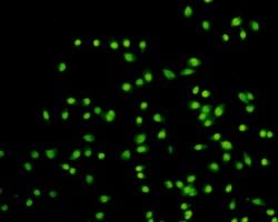 Invitrogen H3K9me3 Monoclonal Antibody (1-6) 100 &mu;L | Buy Online | Invitrogen&trade; | Fisher Scientific