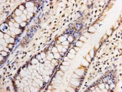 Invitrogen GATA4 Monoclonal Antibody (7-4) 100 &mu;L; Unconjugated:Antibodies,