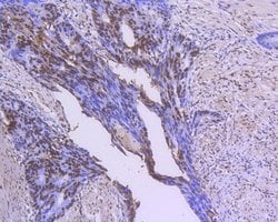 Invitrogen GATA4 Monoclonal Antibody (7-4) 100 &mu;L; Unconjugated:Antibodies,