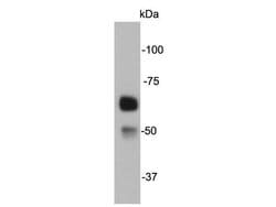 Invitrogen Catalase Monoclonal Antibody (4-G10) 100 &mu;L; Unconjugated:Antibodies,