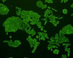 Invitrogen SHP-1 Monoclonal Antibody (B5-A4) 100 &mu;L; Unconjugated:Antibodies,