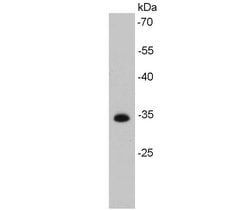 Invitrogen CDK4 Monoclonal Antibody (5-C3-G3) 100 &mu;L; Unconjugated:Antibodies,