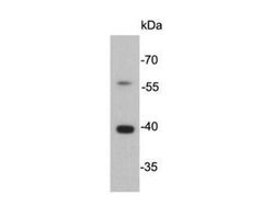Invitrogen Cathepsin B Monoclonal Antibody (J11-A11) 100 &mu;L; Unconjugated:Antibodies,