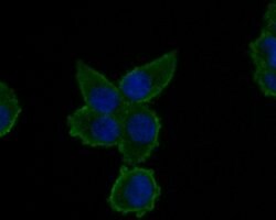 Invitrogen A2M Monoclonal Antibody (A5-A9) 100 &mu;L; Unconjugated:Antibodies,