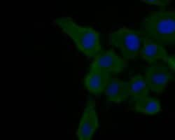 Invitrogen A2M Monoclonal Antibody (A5-A9) 100 &mu;L; Unconjugated:Antibodies,
