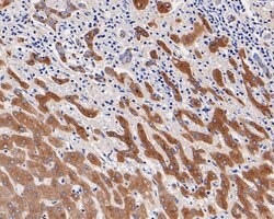 Invitrogen A2M Monoclonal Antibody (A5-A9) 100 &mu;L; Unconjugated:Antibodies,