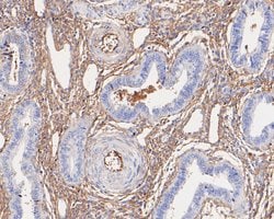 Invitrogen A2M Monoclonal Antibody (A5-A9) 100 &mu;L; Unconjugated:Antibodies,