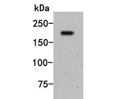 Invitrogen A2M Monoclonal Antibody (A5-A9) 100 &mu;L; Unconjugated:Antibodies,