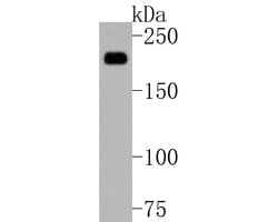 Invitrogen A2M Monoclonal Antibody (A5-A9) 100 &mu;L; Unconjugated:Antibodies,