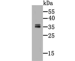 Invitrogen CD137 (4-1BB) Monoclonal Antibody (2G1) 100 &mu;L; Unconjugated:Antibodies,