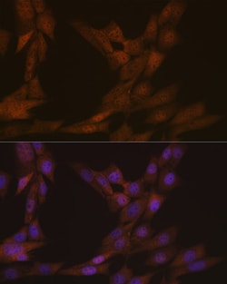 Invitrogen KIFC1 Recombinant Rabbit Monoclonal Antibody (10M10J4) 100 &mu;L;