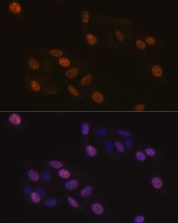 Invitrogen KIFC1 Recombinant Rabbit Monoclonal Antibody (10M10J4) 100 &mu;L;