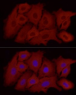 Invitrogen ALDH1A1 Recombinant Rabbit Monoclonal Antibody (3X6B2) 100 &mu;L;