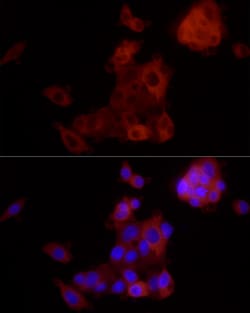 Invitrogen ALDH1A1 Recombinant Rabbit Monoclonal Antibody (3X6B2) 100 &mu;L;