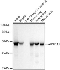 Invitrogen ALDH1A1 Recombinant Rabbit Monoclonal Antibody (3X6B2) 100 &mu;L;