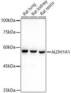 Invitrogen ALDH1A1 Recombinant Rabbit Monoclonal Antibody (3X6B2) 100 &mu;L;