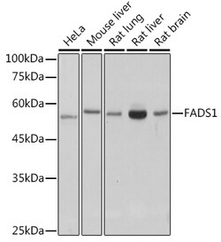 Invitrogen FADS1 Recombinant Rabbit Monoclonal Antibody (1M8L2) 100 &mu;L;