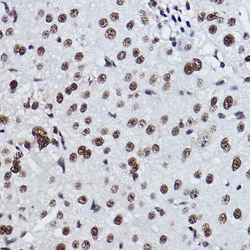 Invitrogen EXOSC7 Recombinant Rabbit Monoclonal Antibody (0B8G6) 100 &mu;L;