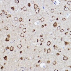 Invitrogen CARS Recombinant Rabbit Monoclonal Antibody (7V0X1) 100 &mu;L;
