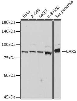 Invitrogen CARS Recombinant Rabbit Monoclonal Antibody (7V0X1) 100 &mu;L;