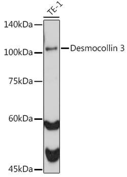 Invitrogen Desmocollin 3 Recombinant Rabbit Monoclonal Antibody (7H1O6)