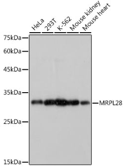 Invitrogen MRPL28 Recombinant Rabbit Monoclonal Antibody (3B9F2) 100 &mu;L | Buy Online | Invitrogen&trade; | Fisher Scientific
