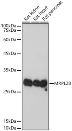 Invitrogen MRPL28 Recombinant Rabbit Monoclonal Antibody (3B9F2) 100 &mu;L | Buy Online | Invitrogen&trade; | Fisher Scientific