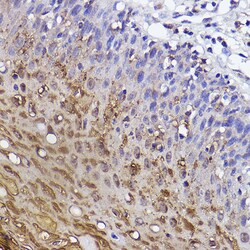 Invitrogen SERPINB3 Recombinant Rabbit Monoclonal Antibody (6J3U6) 100
