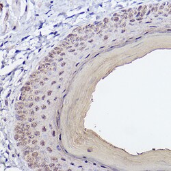 Invitrogen SERPINB3 Recombinant Rabbit Monoclonal Antibody (6J3U6) 100