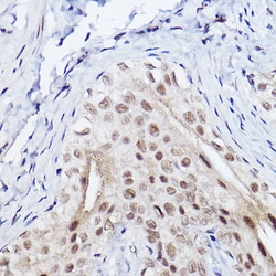 Invitrogen SERPINB3 Recombinant Rabbit Monoclonal Antibody (6J3U6) 100