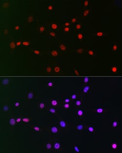 Invitrogen CtBP2 Recombinant Rabbit Monoclonal Antibody (1R1U6) 100 &mu;L;