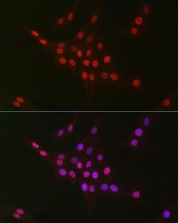 Invitrogen CtBP2 Recombinant Rabbit Monoclonal Antibody (1R1U6) 100 &mu;L;