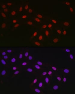 Invitrogen CtBP2 Recombinant Rabbit Monoclonal Antibody (1R1U6) 100 &mu;L;
