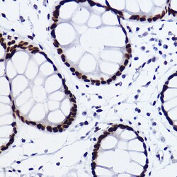 Invitrogen CtBP2 Recombinant Rabbit Monoclonal Antibody (1R1U6) 100 &mu;L;