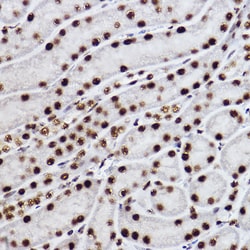 Invitrogen CtBP2 Recombinant Rabbit Monoclonal Antibody (1R1U6) 100 &mu;L;